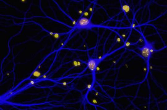 Alzheimer’s: the BRCA1 protein linked to memory disorders