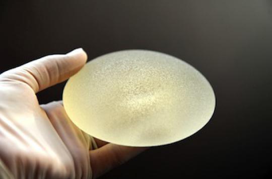 Cancer and breast implants: 173 cases worldwide