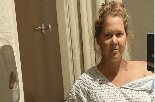 Actress Amy Schumer had to have her uterus removed due to endometriosis