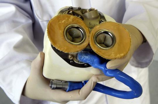 Artificial heart: what Carmat will say to the Ministry of Health