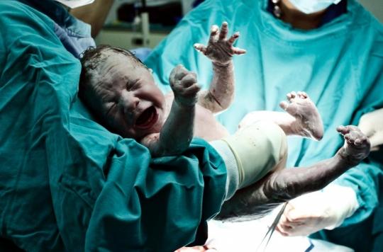 Caesarean section fifty times more deadly for African women