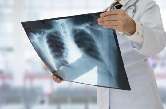 Silicosis: a way to prevent the destruction of the lungs