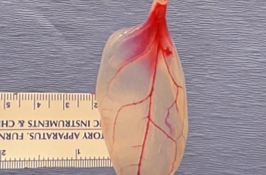 Growing heart tissue with spinach leaves