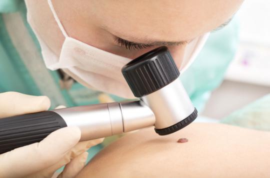 Melanoma: mortality expected to drop by 2050