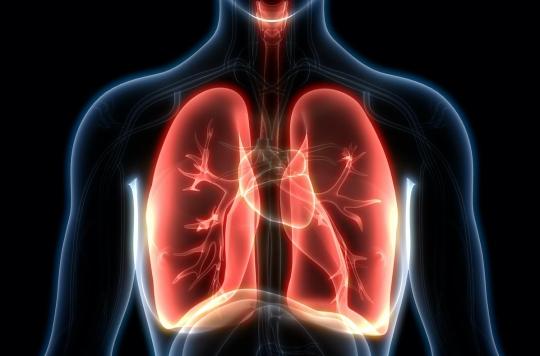 Hyperventilation facilitates radiation treatment of cardiac arrhythmias