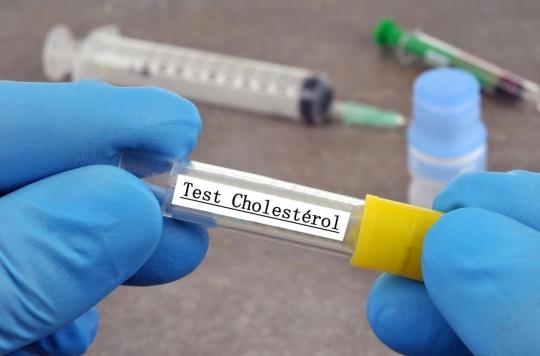 Cholesterol: get tested early to reduce long-term cardiovascular risks