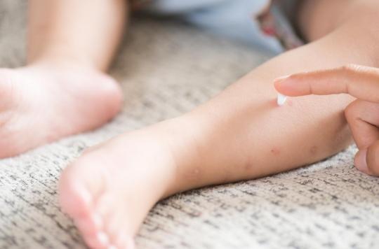 Comment Bien Proteger Les Enfants Contre Les Moustiques