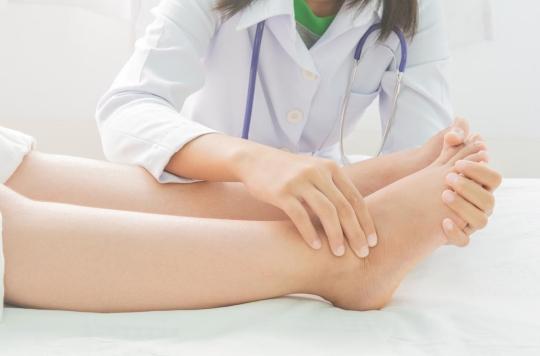 Swollen legs: 5 possible causes