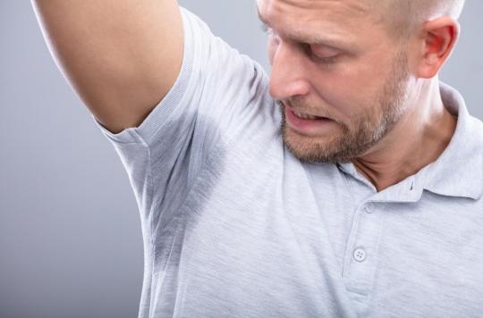 Excessive sweating: botox would be effective!