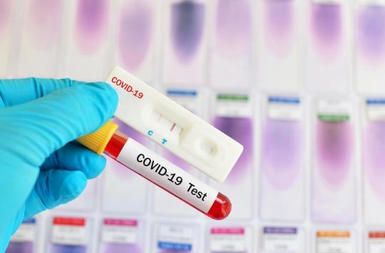 Trod test and PCR test: what are the differences?