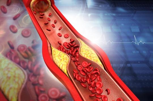 Cholesterol: a herbal treatment under study