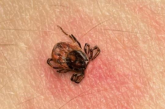 Lyme disease: contention in France and new recommendations in Great Britain