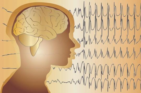 Ultrasound to detect epilepsy earlier