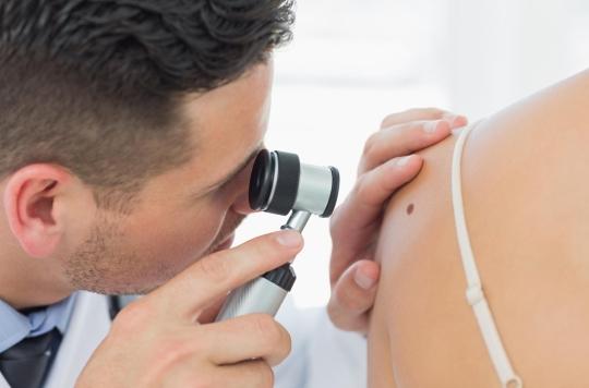 Skin cancer: this diet would help fight it