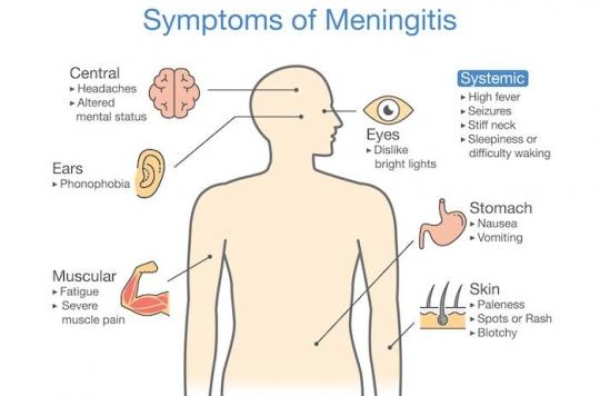 Meningitis: a 20-year-old young woman dies, what signs should alert?