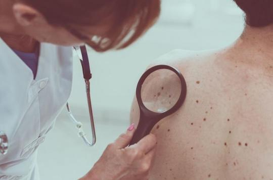 Melanoma: a cancer vaccine is 100% effective in mice