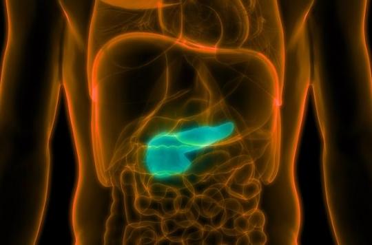 Pancreatic cancer: mortality rate has increased across Europe