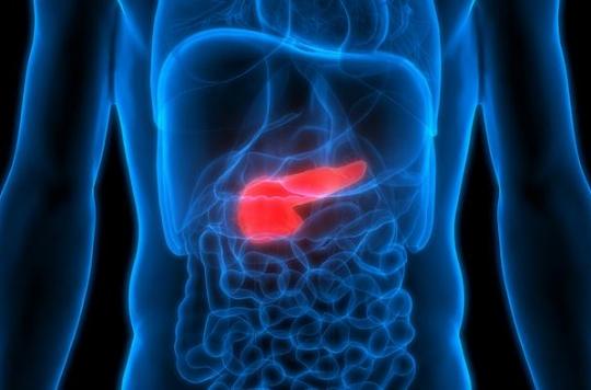 Pancreatic cancer: chemo-radiotherapy before surgery improves survival