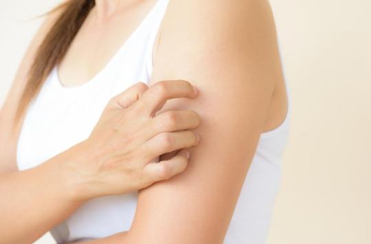 Excess iron in the body could promote skin infections 