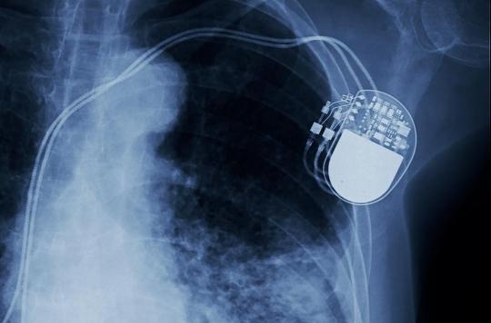 Waiting for heart surgery: a transient pacemaker that harmlessly dissolves in the body