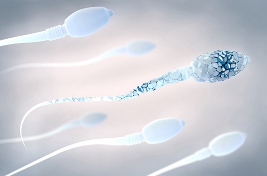 Decline in sperm quality