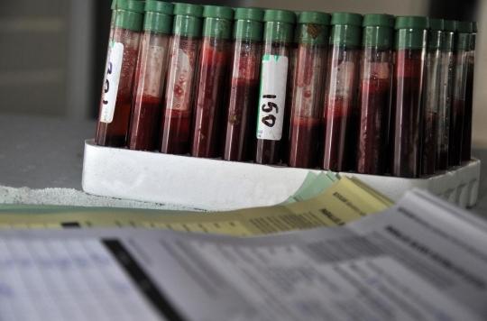 Tuberculosis: soon a blood test to diagnose people at risk? 