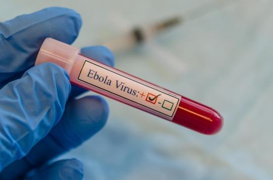 Ebola: the virus can persist in the brain for years