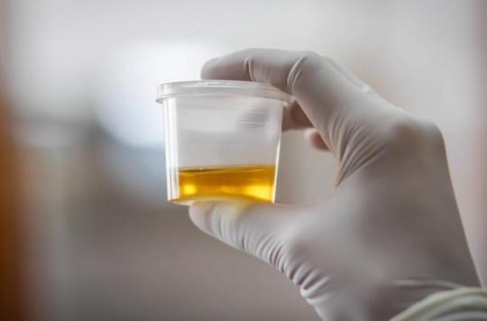 Prostate cancer: the level of spermine in the urine makes it possible to assess the risk