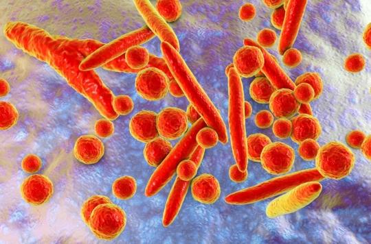 STI: an antibiotic-resistant superbug worries scientists