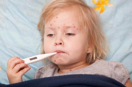 Measles: 405 cases in France since the start of the year