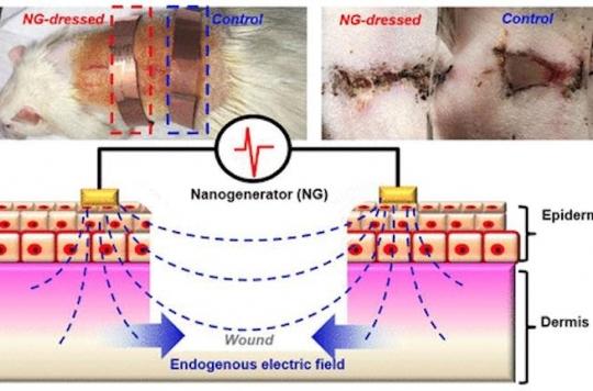 Electric bandages for healing five times faster 