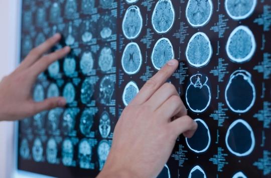 A hundred cases of brain tumors in the same American high school