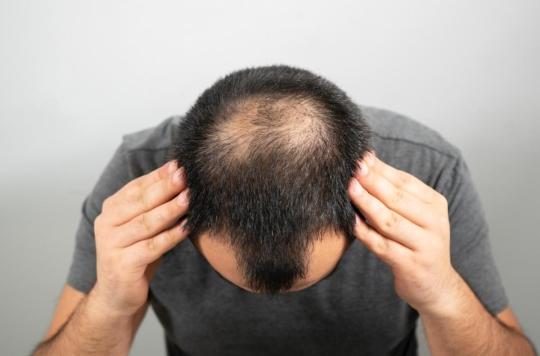 Baldness, soon healed?