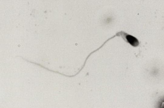 French researchers would have conceived spermatozoa in vitro