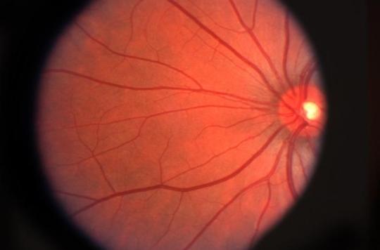 Alzheimer’s: early detection in the retina