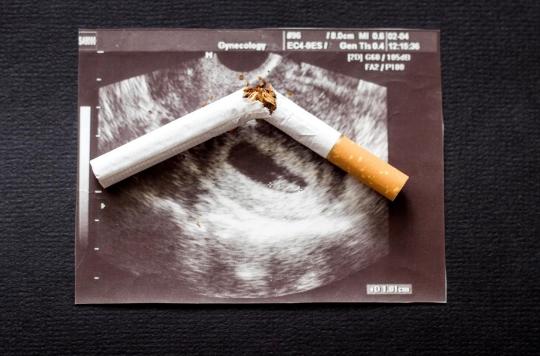 The placenta retains the memory of exposure to tobacco before pregnancy