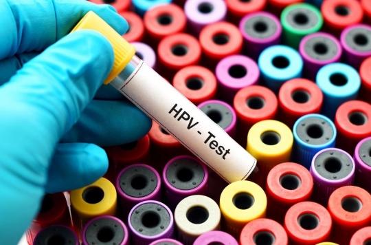 Cervical cancer: the HPV test recommended for women over 30