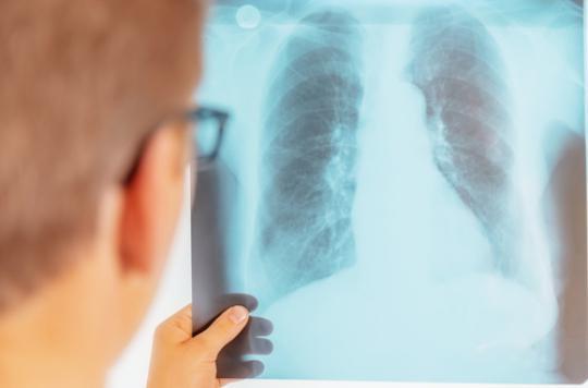 Tuberculosis: WHO recommends rapid diagnostic test