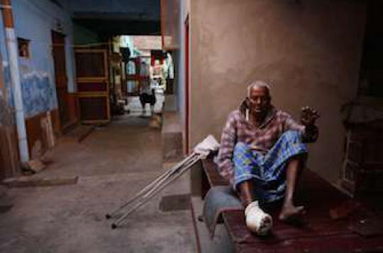 Leprosy: 200,000 victims each year worldwide