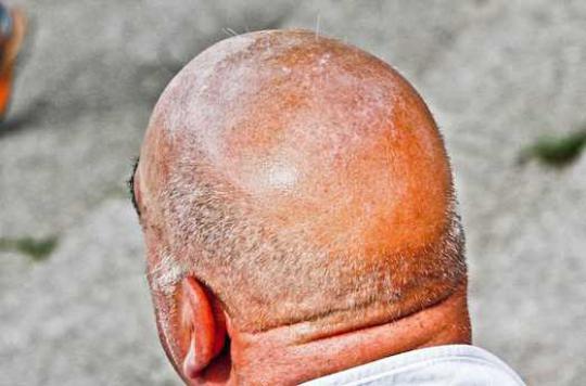 A molecule proven to fight against baldness