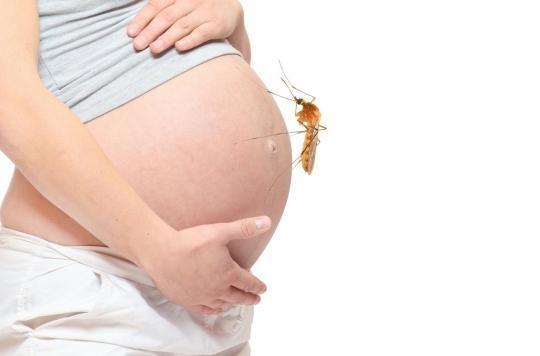 Zika: babies exposed to the virus suffer from developmental delay