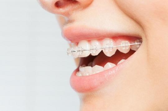 Resins used in dental appliances could harm fertility