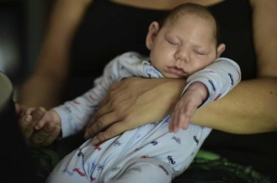 Zika 10 Des Femmes Enceintes Ont Eu Un Enfant Atteint De Malformation
