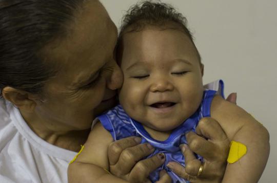 Zika: how the infection causes microcephaly