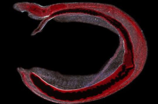 Bilharzia: a 6,200-year-old parasite discovered in Syria