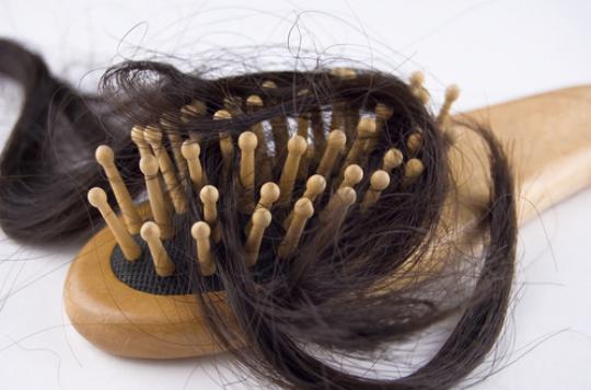 Alopecia: wigs better reimbursed for patients