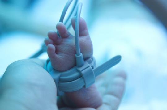 Syndrome Du Bebe Secoue Un Nourrisson De Cinq Mois Handicape A 95